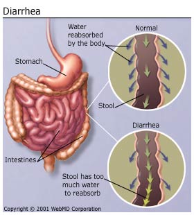 diarrhea.jpg